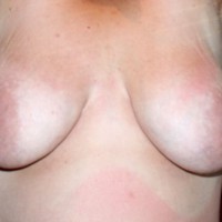 Pic #6 Topless Me Tan Lines