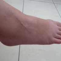Pic #6 Just Feet and Legs