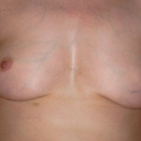 Pic #3 My Sweety Nude