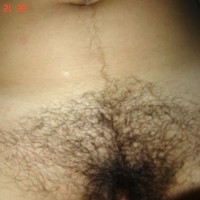 Hairy
