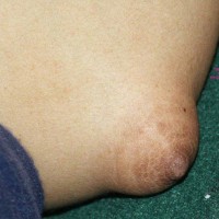 Pic #5 My Puffy Gf no 2