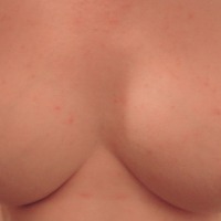 Medium tits of my ex-wife - Emily