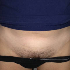 Pic #1 Winter And Summer - Lingerie, Bush Or Hairy