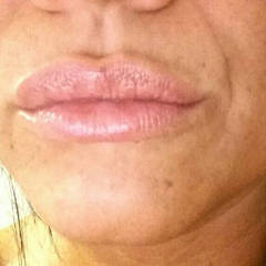 Pic #1 Her Lips
