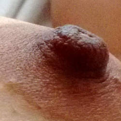 Pic #10 At Motel - Bush Or Hairy