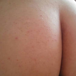 Pic #3 Dite - Close-ups