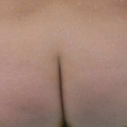 Pic #2 Red Hairy Bush - Amateur