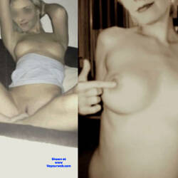 Pic #5 After Breast Silicone - Nude Girls, Big Tits, Blonde, Amateur