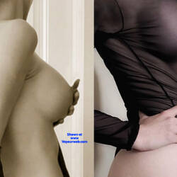 Pic #3 After Breast Silicone - Nude Girls, Big Tits, Blonde, Amateur