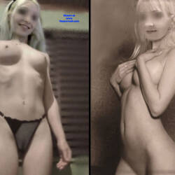 Pic #7 After Breast Silicone - Nude Girls, Big Tits, Blonde, Amateur