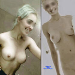 Pic #8 After Breast Silicone - Nude Girls, Big Tits, Blonde, Amateur
