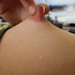 My medium tits - Chickpea