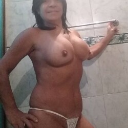 Pic #6 Tetas operadas 4 - Big Tits, Topless Amateurs, Topless Wives, Hard Nipples