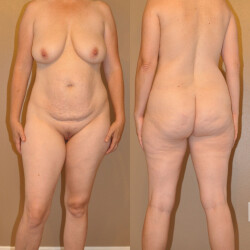 Large tits of my wife - Saggy_Kerry