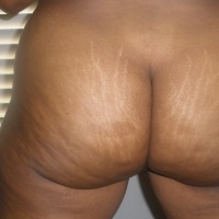 My ass - RDY
