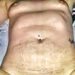 Pic #4 nude shows small saggy mom tits